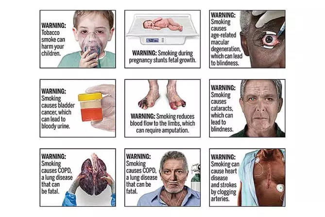 이래도 피울래? FDA 흡연위험 경고 이미지들“충격적”