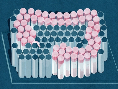 식습관이 대장암 발병에 미치는 영향은