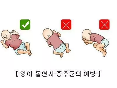 "수면 중 경련 발작, 유아 돌연사 잠재적 원인일 가능성"