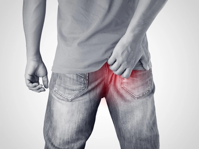 항문이‘간질간질’… 커피·차·콜라·초콜릿 속 크산틴 성분 때문?