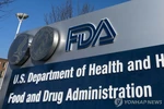 FDA "스마트워치 이용한 혈당 측정 피하라" 경고