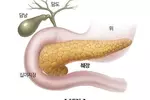 "췌장 지방 과다, 뇌 건강과 관계있다"