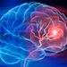 에모리의대 새 뇌졸증 치료법 개발