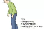 "50세 이후 불안증 생기면 파킨슨병 위험 두 배 높아진다"