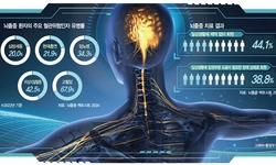 노년층 위협 뇌졸중… 콜레스테롤만 잡아도 재발 위험‘뚝’