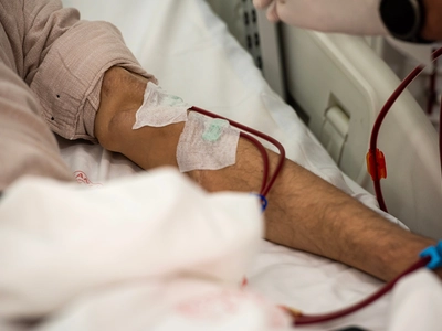 혈액투석 환자에게 꼭 필요한‘동정맥루 조성술’은?