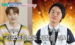 박서진, 성형 비용만 1억..충격적 과거 사진 “웃기게 생겨”