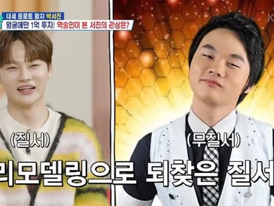 박서진, 성형 비용만 1억..충격적 과거 사진 “웃기게 생겨”