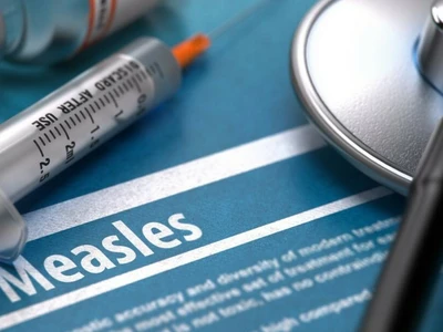 조지아서도 3명 홍역 감염…모두 회복