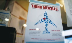 ‘공기로 전염’ 홍역 확산 비상… 비행기는 안전한가