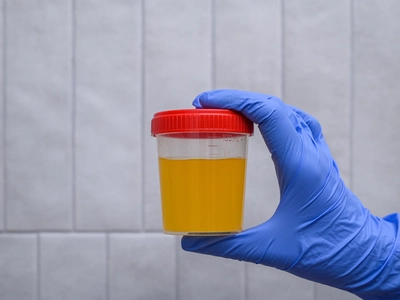 “소변이 호박색? 정말 큰일 날 수도”… 여름철 탈수 주의