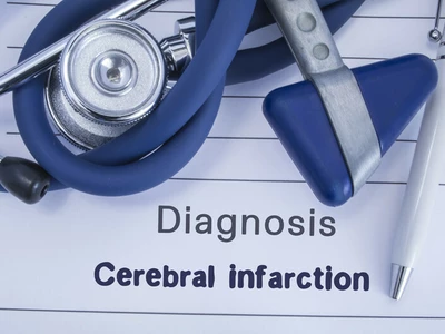 불시에 찾아오는 뇌경색… 재관류술 후 ‘이차손상’ 막을 해법 찾았다