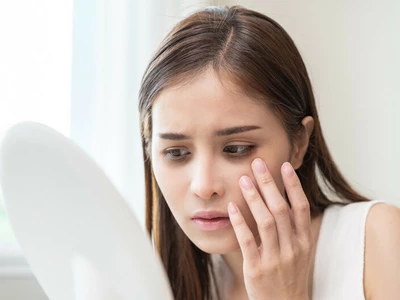 쉬어도 판다처럼 짙어지는 ‘다크서클’… ‘이 병’ 때문일수도