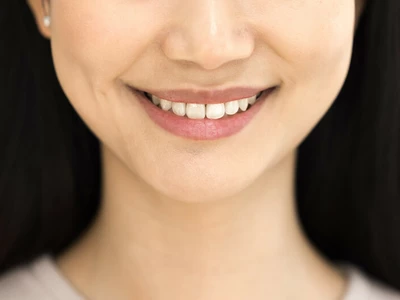 치아 교정 똑같이 받아도… 50대 아빠가 엄마보다 만족, 왜