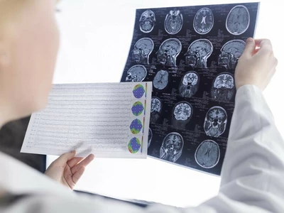 간단한 혈액검사로 알츠하이머를 예측할 수 있을까