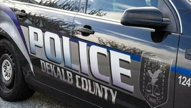 디캡 여성, 키우던 반려견 공격으로 사망