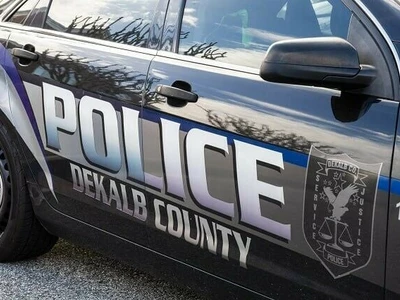 디캡 여성, 키우던 반려견 공격으로 사망