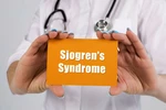 “눈이 뻑뻑하고 입이 바짝바짝 타요”… 쇼그렌증후군 의심을