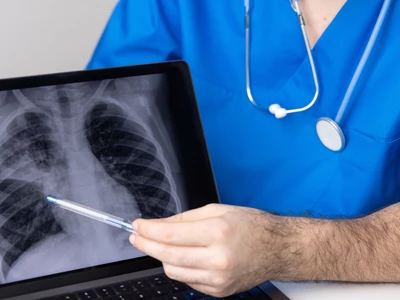 “폐 건강 위해선 금연뿐 아니라, 내장지방 관리도 중요”