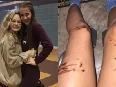 용감한 여고생...상어와 격투 끝 구사일생