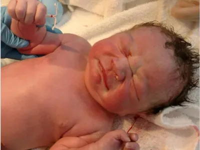 '갓 태어난 아기 손에 피임기구가 들려있네...'