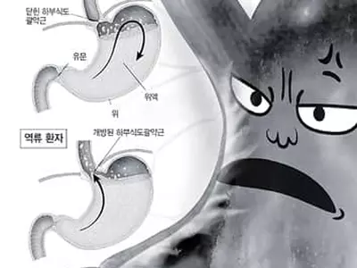 잘못된 식습관‘분노의 역류' 부른다