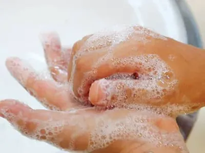 여름 감기라도 고열·발진 땐 병원 찾아야