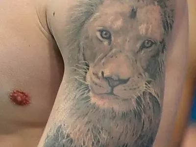 문신 부위 땀 적어‘건강 적신호”