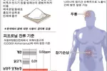 닭에 사용금지된‘피프로닐’성분 오염