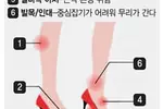 멋 내려다... 신는 족족 아프다