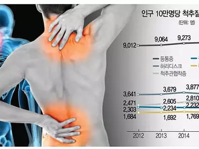 연간 800만명 괴롭히는 척추질환 연령마다 단골 부위 따로 있다는데…