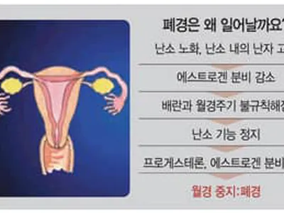 이유없이 눈물… 밤새 뒤척… 남녀 모두 피할 수 없는 ‘갱년기’