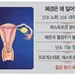 이유없이 눈물… 밤새 뒤척… 남녀 모두 피할 수 없는 ‘갱년기’