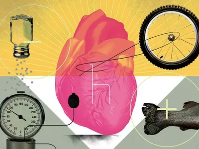 식단,생활방식 바꾸면 대동맥 클라크