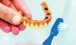 틀니 사용자 70%가 구내염… 매일 전용 세정제로 씻으세요
