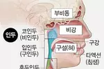 40세이상 흡연자‘이비인후과 내시경’받으세요