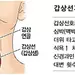 스마트워치로 갑상선기능항진증 조기 판별