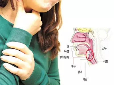 마른 기침 계속되는데… 도대체 왜?