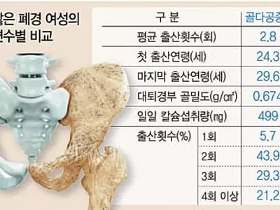35세 이후 출산땐 더 骨骨〈골골〉해요