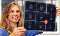 ‘내 머릿속 지우개’ 증상, 폐경이 원인일 수도