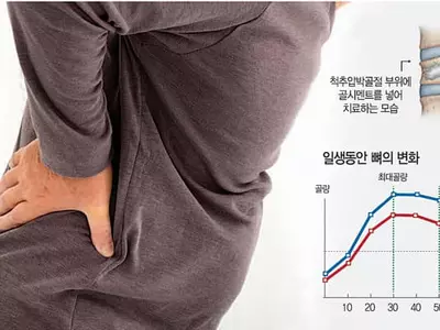 부모님 ‘굽은 허리’ 막으려면 평소 뼈건강·근력 챙기세요