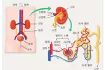 신장 망가질 때까지 증상 없어… 소금 줄여야