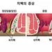 화장실 용무 5분 내 마치고 배변 과도한 힘 주지 말아야