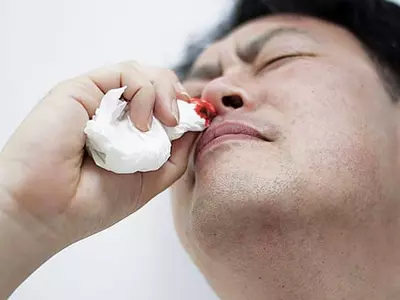 코피가 날 때 고개를 뒤로 젖히지 마세요