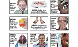 이래도 피울래? FDA 흡연위험 경고 이미지들“충격적”