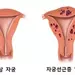 난임여성 10명중 1명 갑상선·부인과 질환