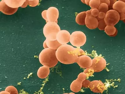 췌장 침투한 곰팡이가 암 유발할 수도