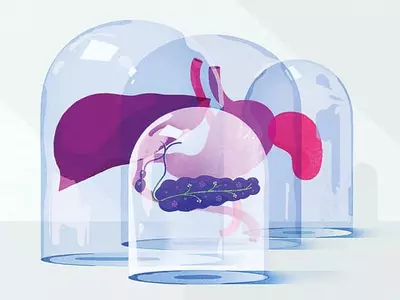 췌장암은 왜 발견과 치료가 어려울까?