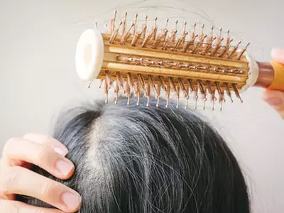 겨울철 탈모관리의 A to Z