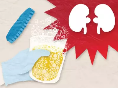 거품 많은데‘쉬쉬’… 콩팥 망가질라